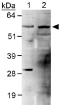 PAB12070 - PLTP