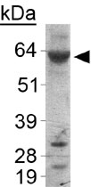 PAB12071 - Perilipin-1