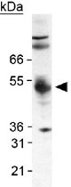 PAB12077 - PDK1