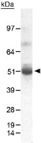 PAB12078 - PDK1