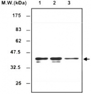 PAB1208 - DFFB / CAD