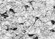 PAB12085 - OGG1