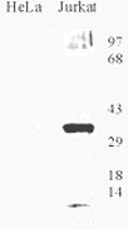 PAB12085 - OGG1