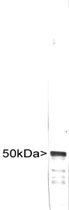 PAB12100 - Vimentin