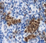 PAB12104 - Lysyl oxidase