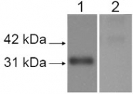 PAB12104 - Lysyl oxidase