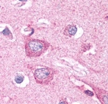 PAB12110 - DISC1