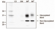 PAB12114 - Aquaporin-2 / AQP2