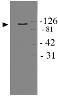 PAB12116 - APBB1 / FE65