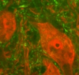 PAB12117 - Neurofilament H (200 kD)