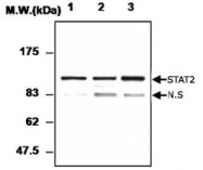 PAB1212 - STAT2