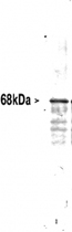 PAB12120 - Neurofilament L (68kDa)