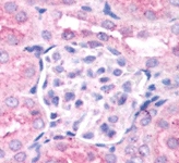 PAB12122 - EGLN1 / PHD2