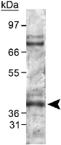PAB12122 - EGLN1 / PHD2