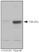 PAB12124 - HIF2A / HIF2 alpha