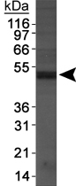 PAB12126 - NAPE-PLD