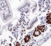 PAB12127 - mKi-67