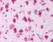 PAB12132 - PARK8 / LRRK2