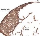 PAB12133 - Laminin alpha 1