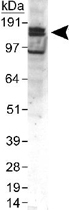 PAB12134 - CD309 / VEGFR-2 / Flk-1