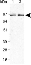 PAB12137 - IREB2