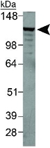 PAB12137 - IREB2