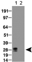PAB12139 - GPIHBP1 / GPI-HBP1