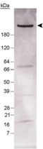 PAB12142 - Fatty acid synthase
