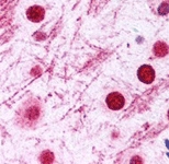 PAB12144 - DISC1