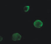 PAB12147 - Calreticulin