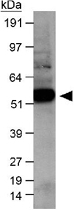 PAB12148 - Calreticulin