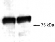 PAB12151 - AGGF1 / VG5Q