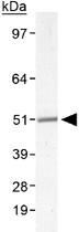 PAB12152 - Adipophilin / ADFP
