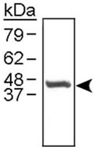 PAB12155 - Cathepsin E
