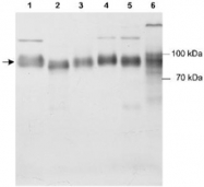 PAB12157 - SCARB2
