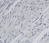 PAB12157 - SCARB2