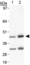 PAB12159 - Perilipin-5