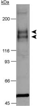 PAB12161 - VEGFR-1 / Flt-1