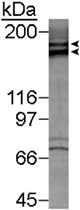 PAB12162 - CD309 / VEGFR-2 / Flk-1