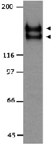 PAB12162 - CD309 / VEGFR-2 / Flk-1
