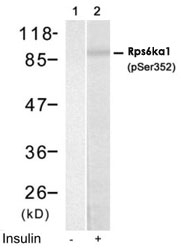 PAB12168 - RPS6KA1