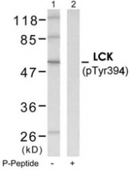 PAB12169 - LCK