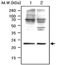 PAB1218 - Peroxiredoxin-1 / PRDX1