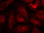 PAB12190 - ABL1
