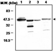 PAB1220 - Glutamine synthetase