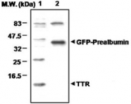 PAB1221 - Transthyretin / Prealbumin