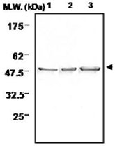 PAB1222 - Neuron specific enolase