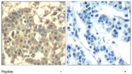 PAB12251 - HGF receptor