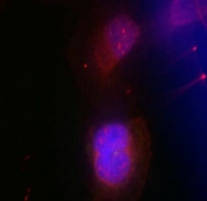 PAB12267 - BRCA1 / RNF53