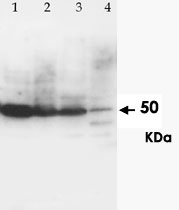 PAB12270 - CD196 / CCR6